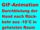 Durchblutung der Hand nach Rckkehr aus -10C in geheizten Raum