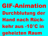 Durchblutung der Hand nach Rckkehr aus -10C in geheizten Raum